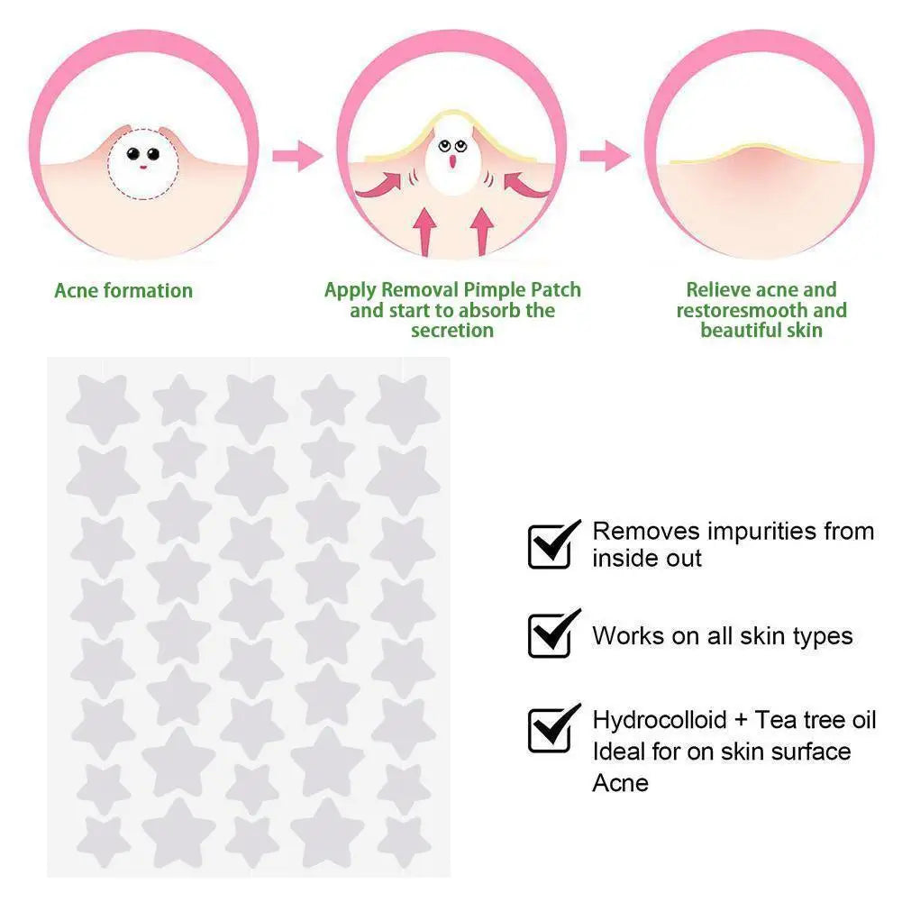 40pcs Pimple Patches Colorful Star-Shaped PE Pimple Patches For Ance Cute And Invisible Pimple Cover Stickers for Pimple Removal